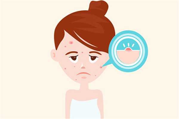 痘痘肌适合用什么洗面奶