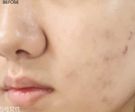 悦诗风吟小白管怎么用 悦诗风吟小白管怎么用