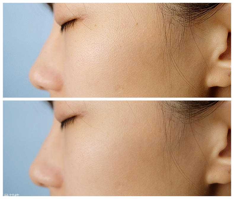 黛珂赋活精华露适合年龄 基础产品不挑年龄