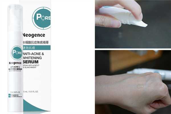 哪款抗痘精华厉害