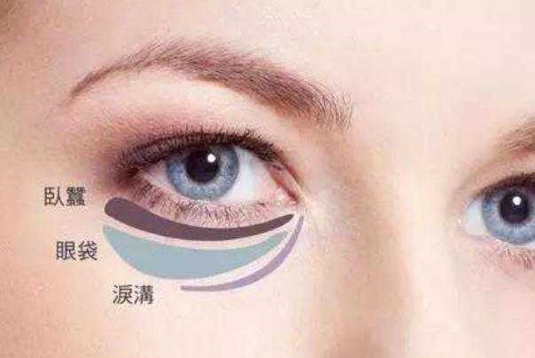 卧蚕和眼袋有什么区别 卧蚕和眼袋有什么区别