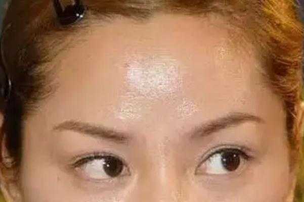 皮肤出油可以直接用散粉吗