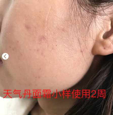 whoo后的天气丹效果怎么样？