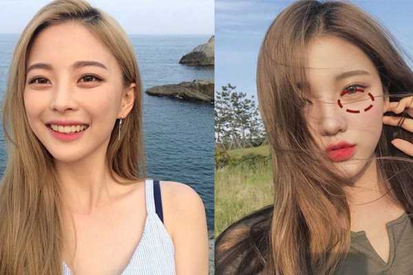 怎样区分眼袋和卧蚕眼