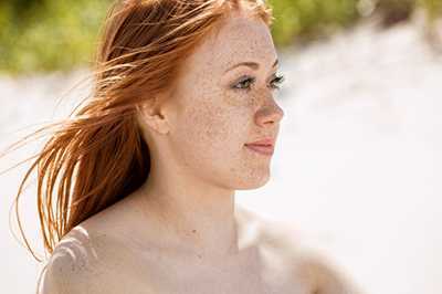 脸上为什么有斑 脸上为什么有斑