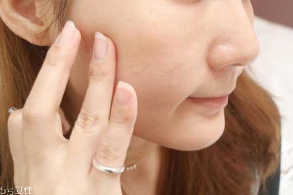 安瓶可以去细纹吗 修复和抗老安瓶能去细纹