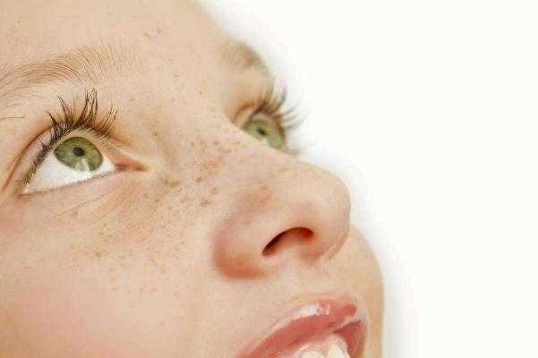 雀斑的形状和颜色 雀斑的危害