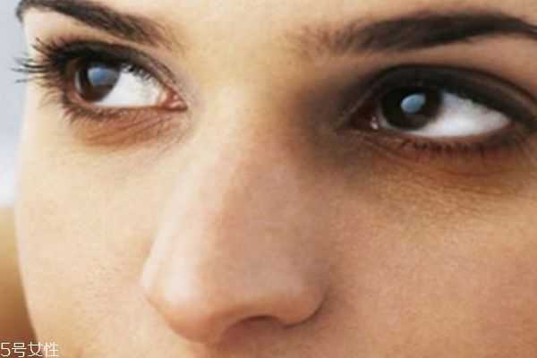 怎样才能有效去除眼袋黑眼圈