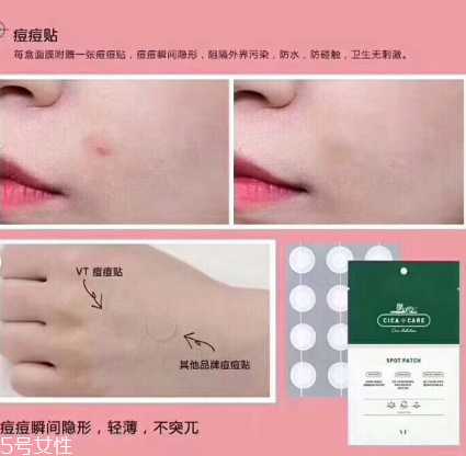vt痘痘贴怎么样 vt痘痘贴怎么样