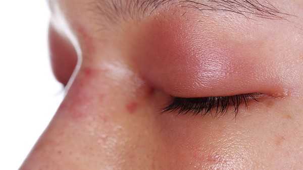 自体脂肪丰胸恢复期是多久?自体脂肪填充常见哪些问题? 自体脂肪丰胸恢复期是多久?自体脂肪填充常见哪些问题?