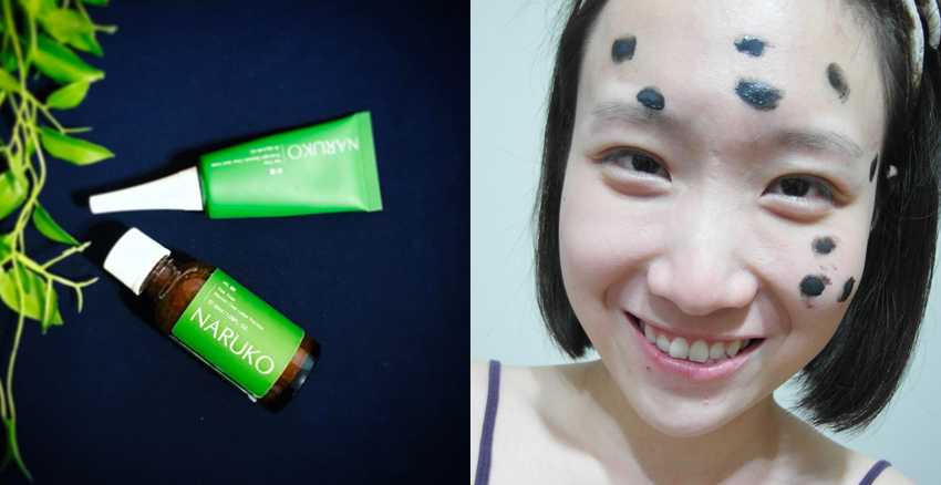 哪款抗痘精华厉害