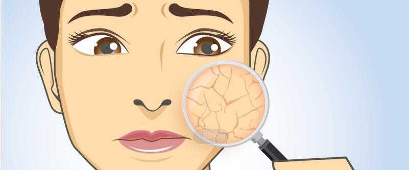 脸干发痒用什么补水 脸干发痒用什么补水