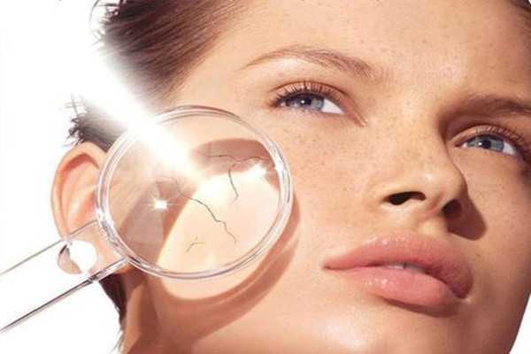 晒斑怎么去除掉？晒斑能彻底根除吗