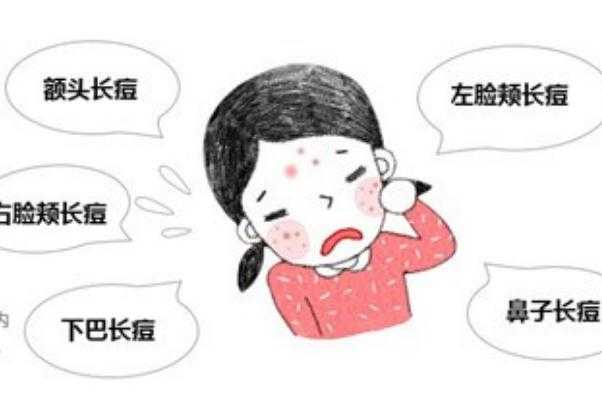 青春痘是皮肤病吗？需要挤掉吗