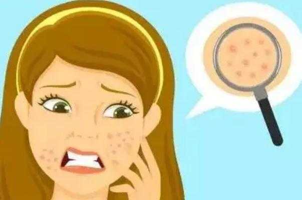 毛孔粗大要补水还是控油 毛孔粗大要补水还是控油