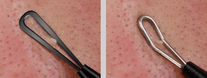 敷完清洁面膜后该干什么