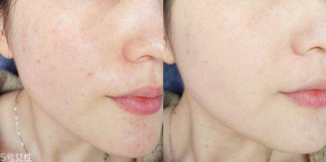 evm原液好用吗 evm原液好用吗