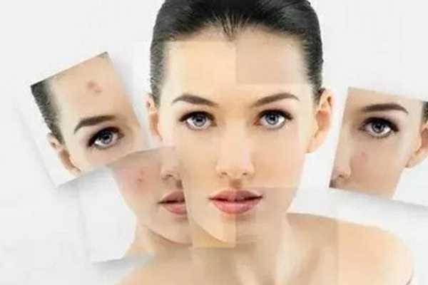 混油皮痘肌隔离推荐 这3款超级好用 混油皮痘肌隔离推荐 这3款超级好用