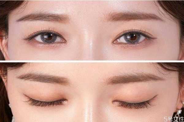 假睫毛会导致眼皮松吗