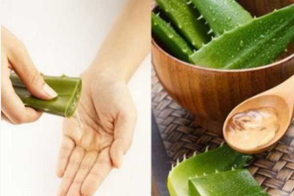 芦荟胶可以祛痘吗 芦荟胶可以祛痘吗