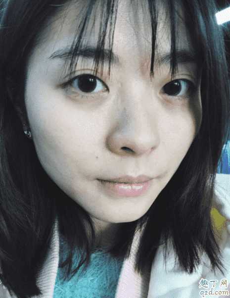 sk2神仙水用了为什么会刺痛？神仙水330ml瓶子里有水雾怎么回事