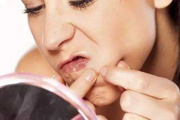 长痘痘能化妆吗 长痘痘能化妆吗