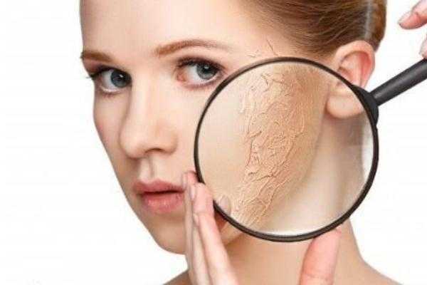 皮肤干燥脱皮严重像鱼鳞怎么办