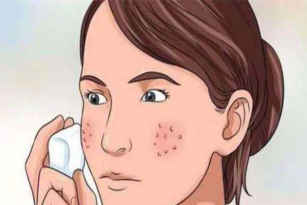 做完清洁面膜如何收缩毛孔 做完清洁面膜如何收缩毛孔