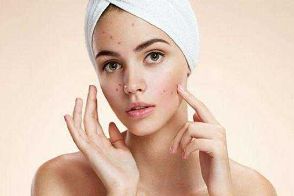 痘痘挤了之后能用酒精消毒吗 痘痘挤了之后能用芦荟胶吗