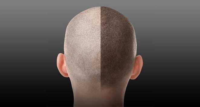 一般纹发大概多少钱 一般纹发大概多少钱