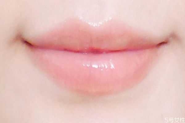 嘴巴起皮怎么办？如何去除唇部的死皮