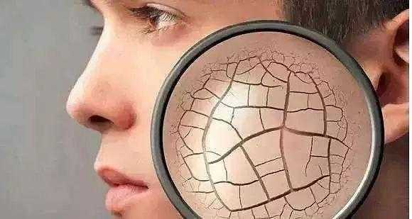 肌肤如何保湿补水？干燥肌肤如何保湿