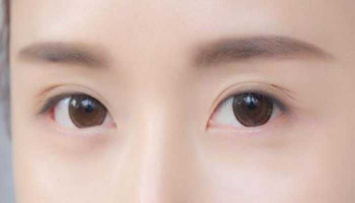 纹眉结痂后用手抠掉了怎么办 纹眉结痂后用手抠掉了怎么办