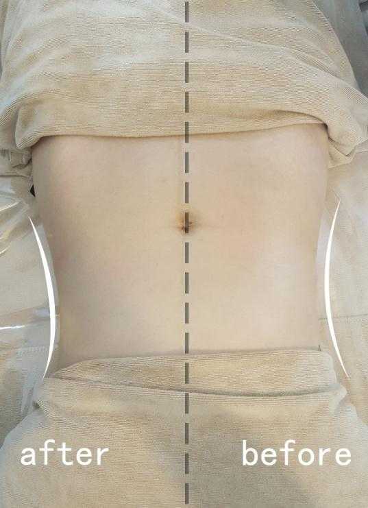 日式整骨有效果吗?效果对比图 日式整骨有效果吗?效果对比图