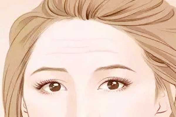 抬头纹可以打肉毒素吗 抬头纹可以打肉毒素吗