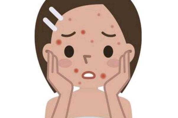 青春痘留下的疤痕怎么才能消除掉 青春痘留下的疤痕怎么才能消除掉