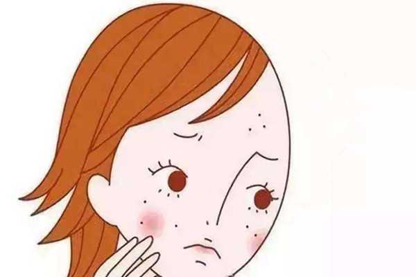 黄褐斑能用药水点掉吗 黄褐斑能用药水点掉吗