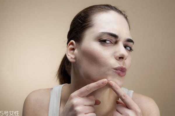 下巴有粉刺怎么去掉 白头粉刺怎么去除小妙招