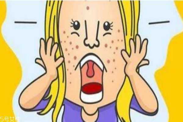 长痘痘怎么护理皮肤 脸上长痘痘如何调理