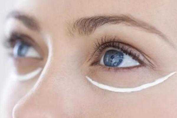 眼袋会不会遗传？眼袋能自然消除吗