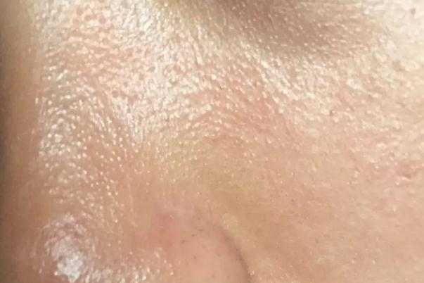 皮肤出油要用洗面奶吗