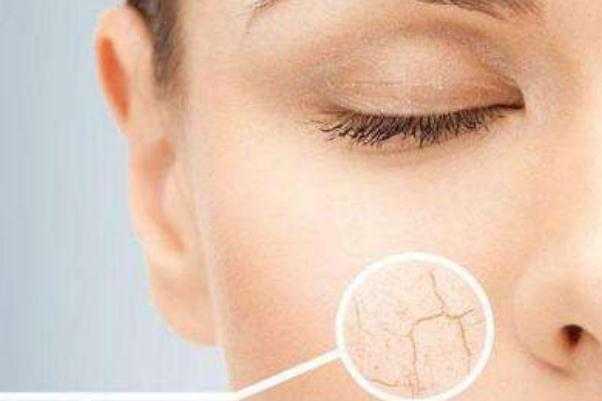 皮肤干燥的症状有哪些