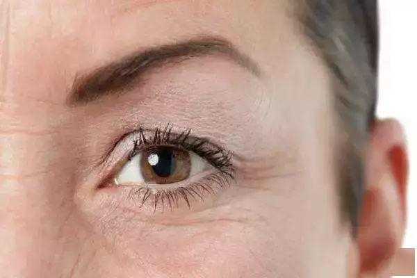 眼部皮肤松弛怎么处理？眼部皮肤松弛是什么原因造成的