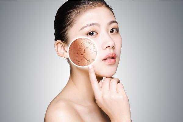 皮肤干燥的症状有哪些