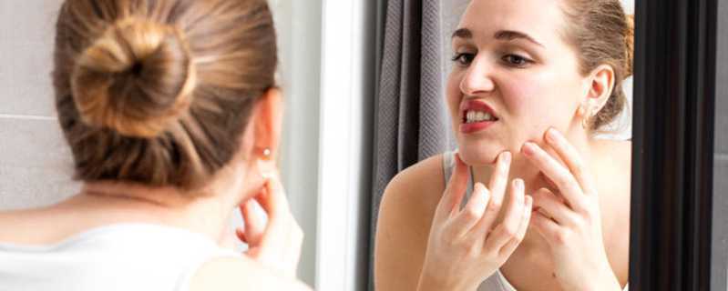 如何治疗下巴的痘痘 如何治疗下巴的痘痘