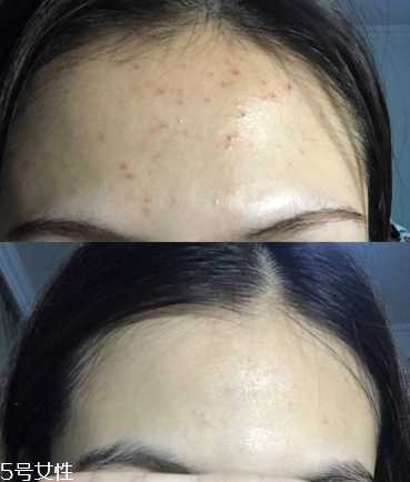 敷尔佳面膜好用吗？敷尔佳面膜怎么看真假