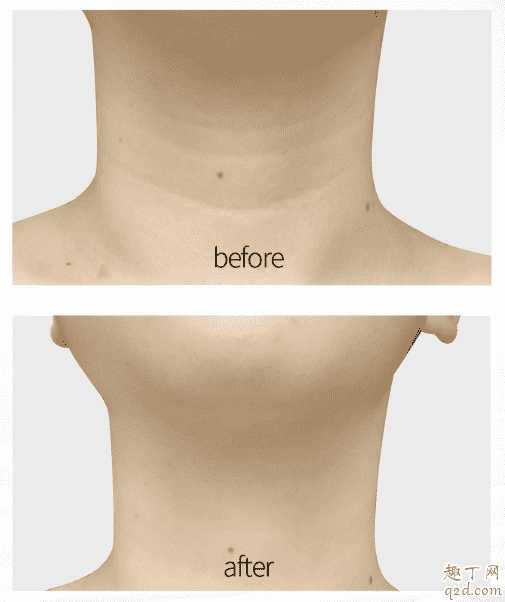 悦芙媞颈霜效果怎么样? 悦芙媞颈霜效果怎么样?