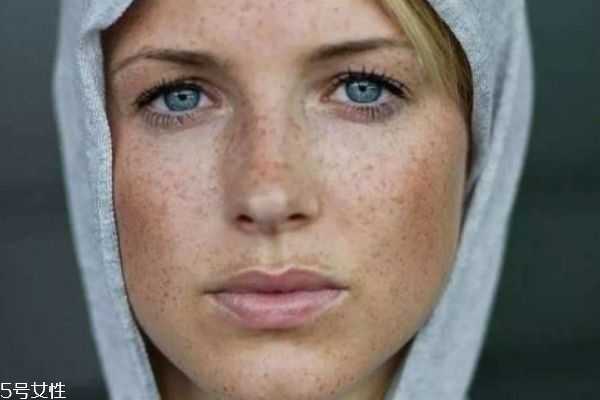 怎么区分斑和痣