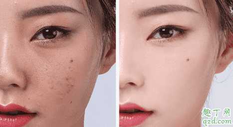 素萃黑醋面膜好用吗 素萃黑醋面膜好用吗