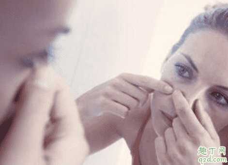 上火起痘痘可以挤破吗？上火长痘怎么快速消除